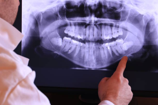 Best Emergency TMJ Treatment in Camanche, IA