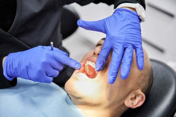 Best After-Hours Dental Trauma Care in Camanche, IA